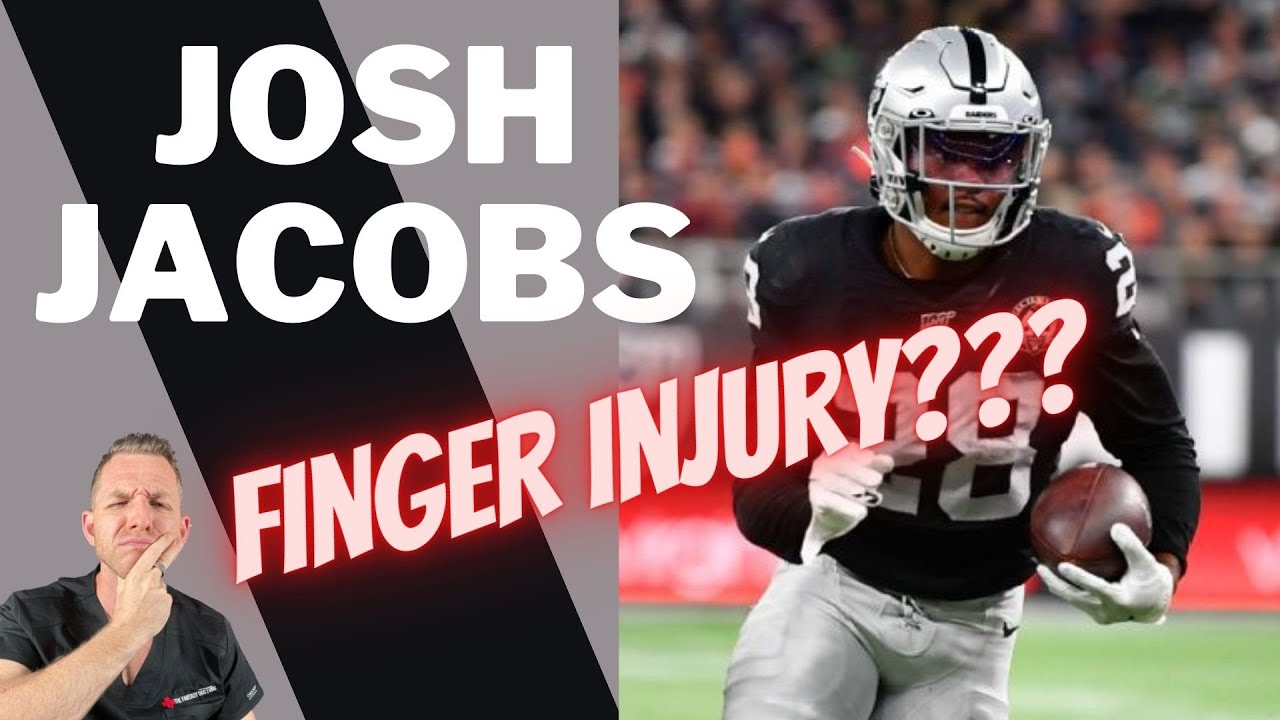 Josh Jacobs – Finger Injury??